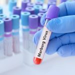 إثيوبيا تعلن تفشي وباء “ماربورغ” جنوب البلاد